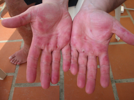 img_2440